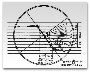 声学测量